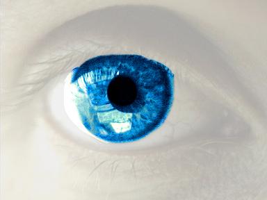 15-eye2.JPG